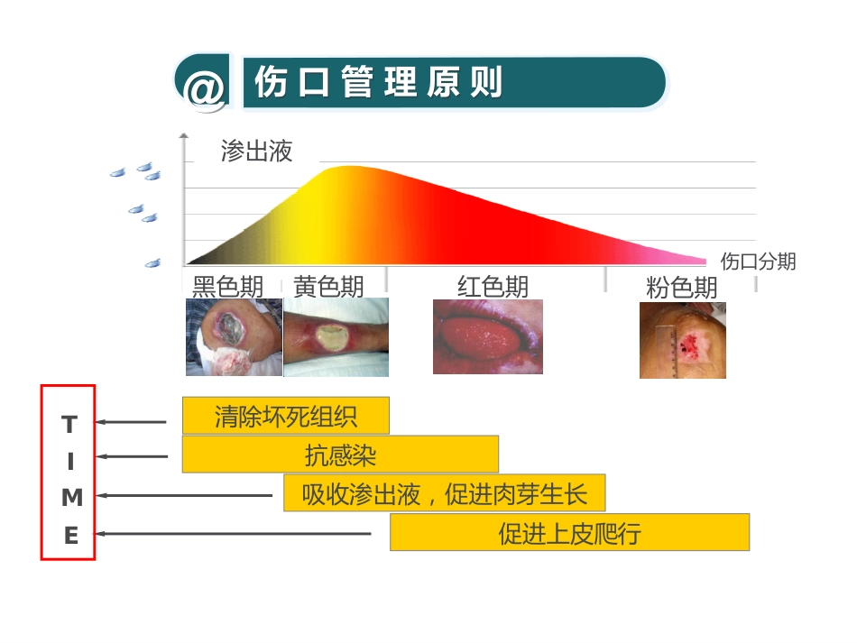 糖尿病压疮伤口个案_第12页
