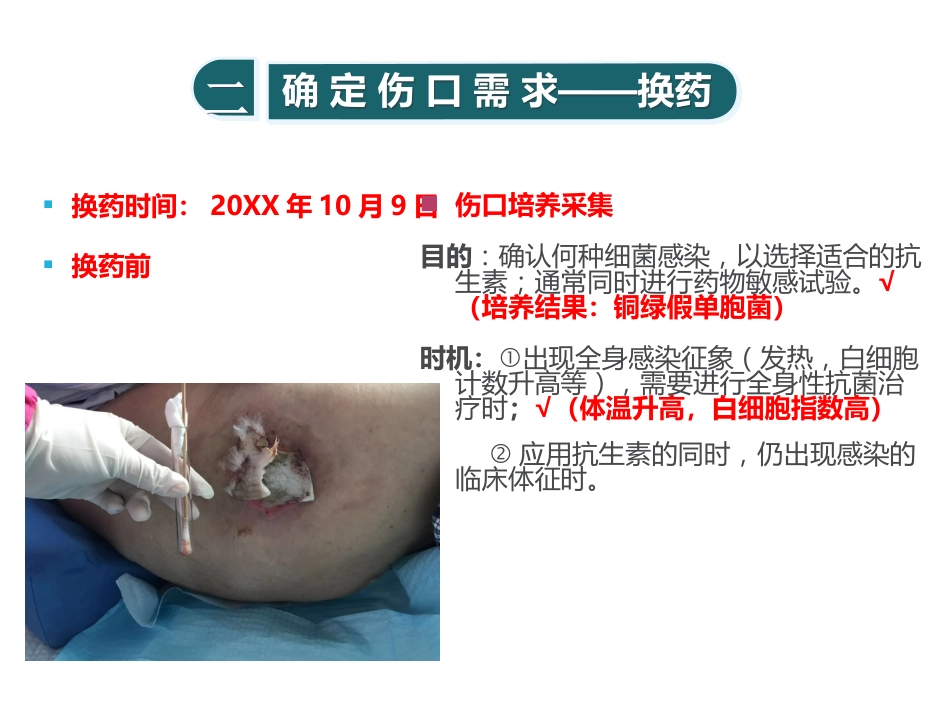 糖尿病压疮伤口个案_第15页