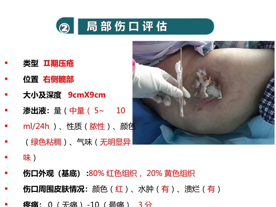 糖尿病压疮伤口个案_第7页