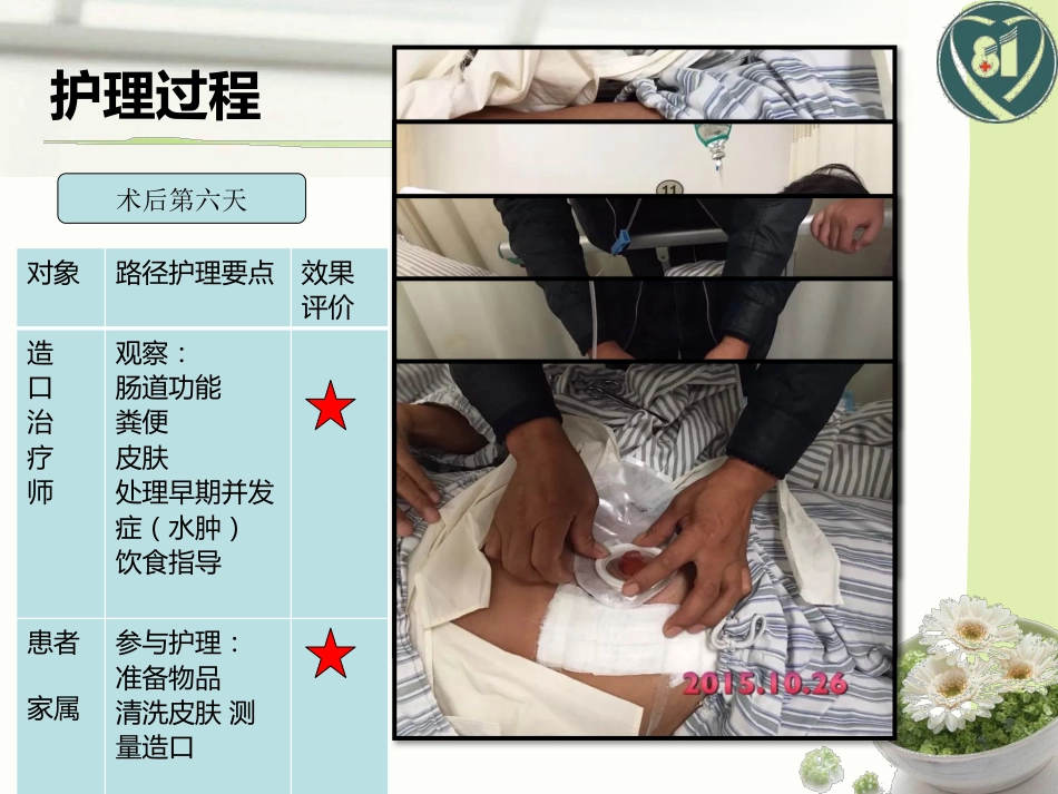 1例直肠癌术后造口护理_第11页