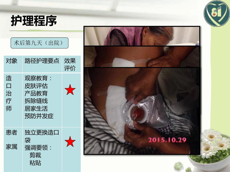 1例直肠癌术后造口护理_第13页