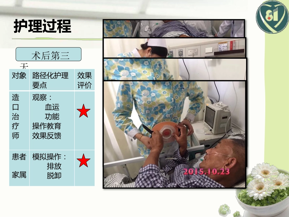 1例直肠癌术后造口护理_第9页
