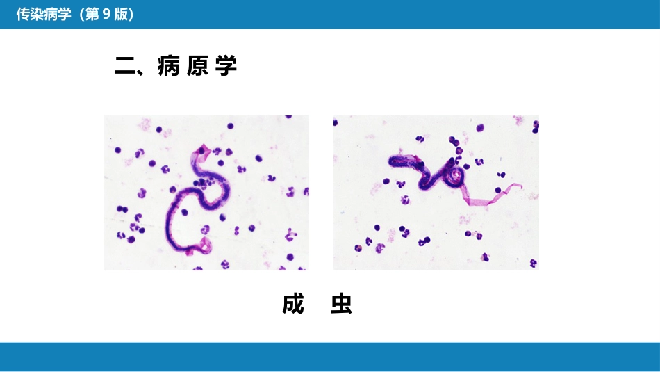 第八章 蠕虫病 第二节 丝虫病_第10页
