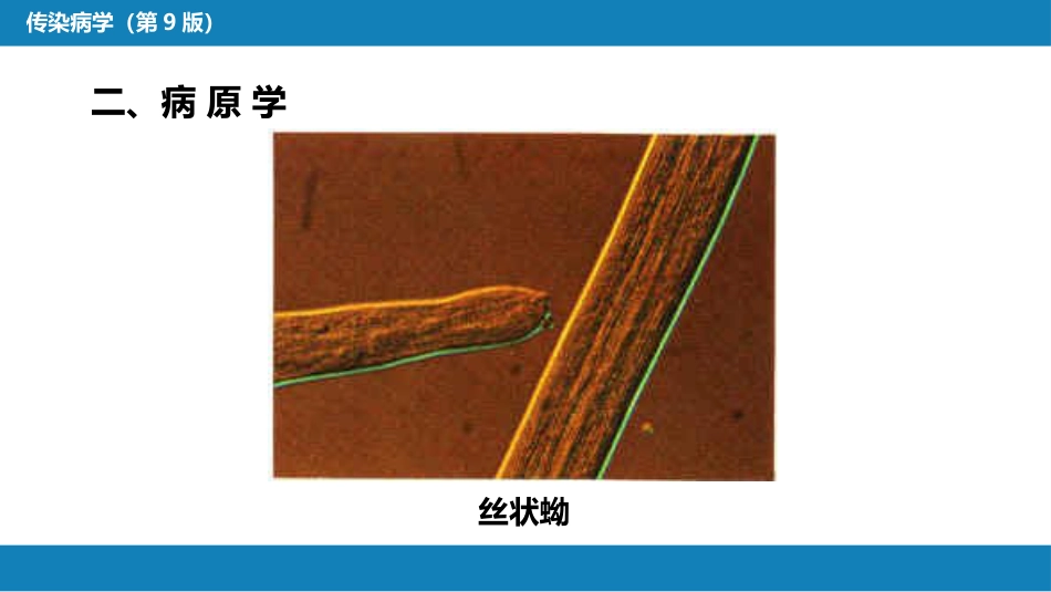 第八章 蠕虫病 第二节 丝虫病_第14页