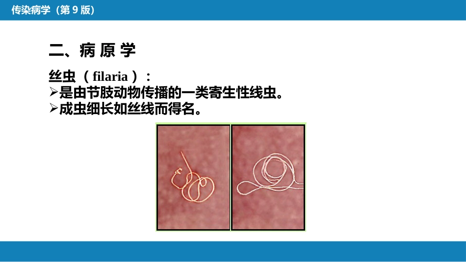 第八章 蠕虫病 第二节 丝虫病_第8页