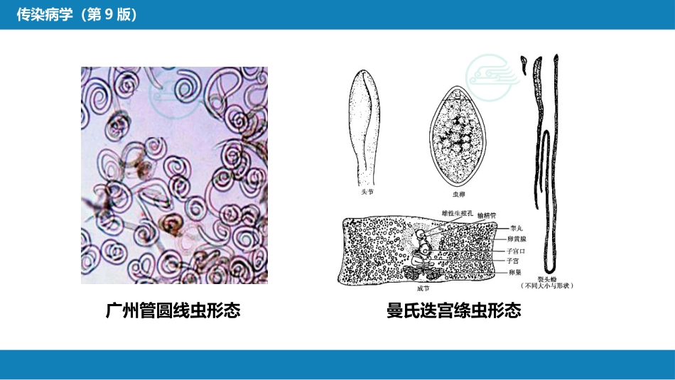 第八章 蠕虫病 第七节 蠕虫蚴移行症_第10页