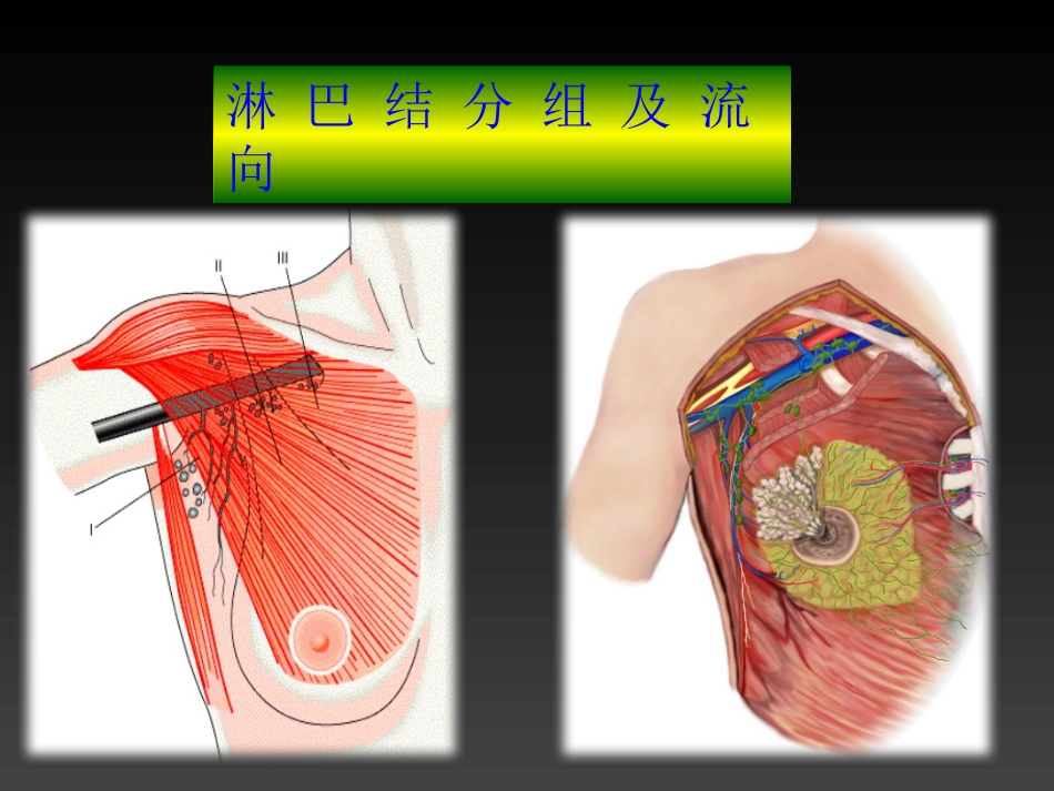 妇产科-乳房疾病_第7页