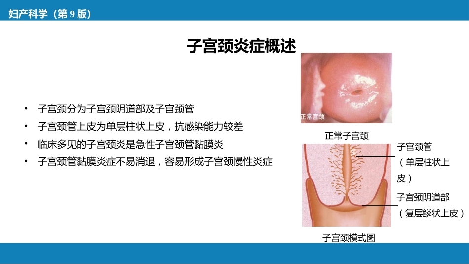 子宫颈炎症._第4页