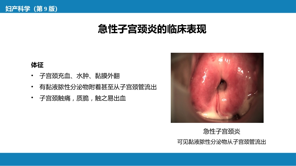 子宫颈炎症._第8页