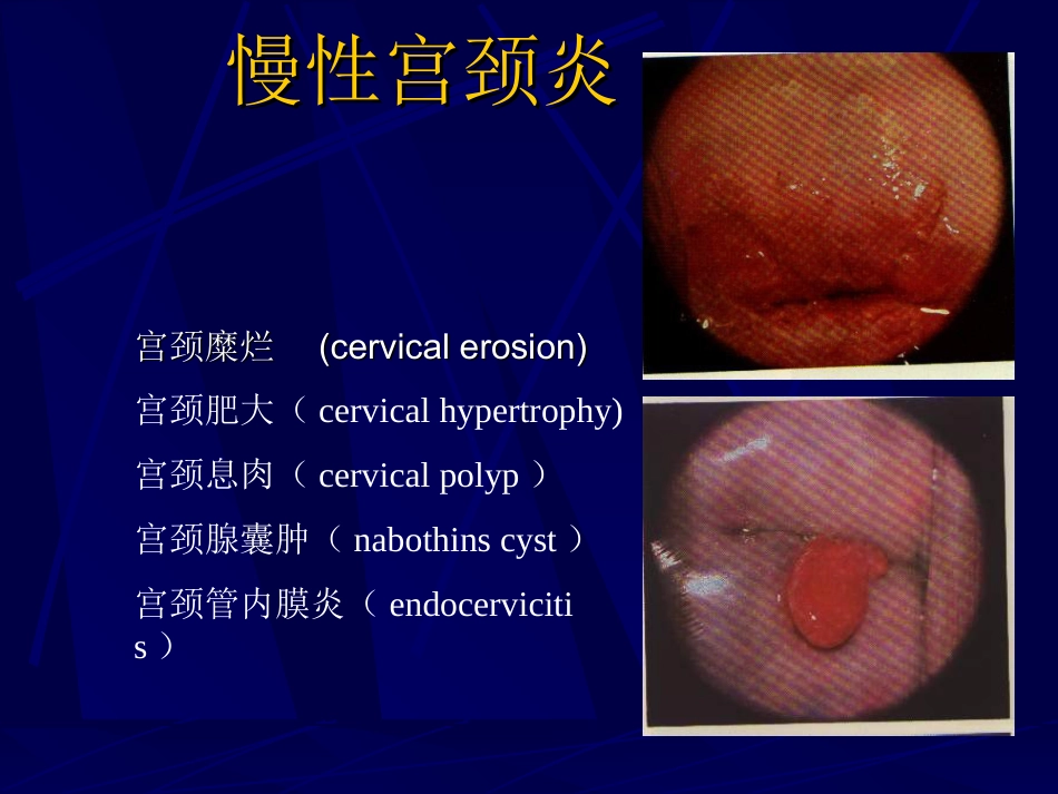 妇产科-盆腔炎宫颈炎_第10页