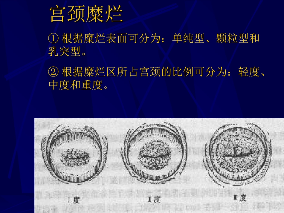 妇产科-盆腔炎宫颈炎_第8页