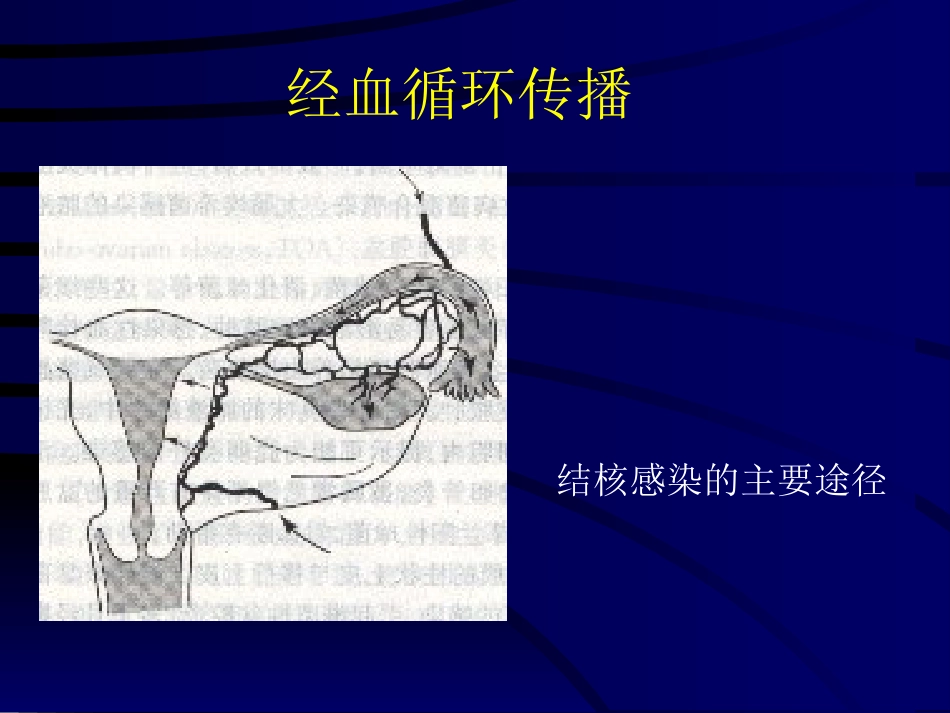 妇产科-盆腔炎_第14页