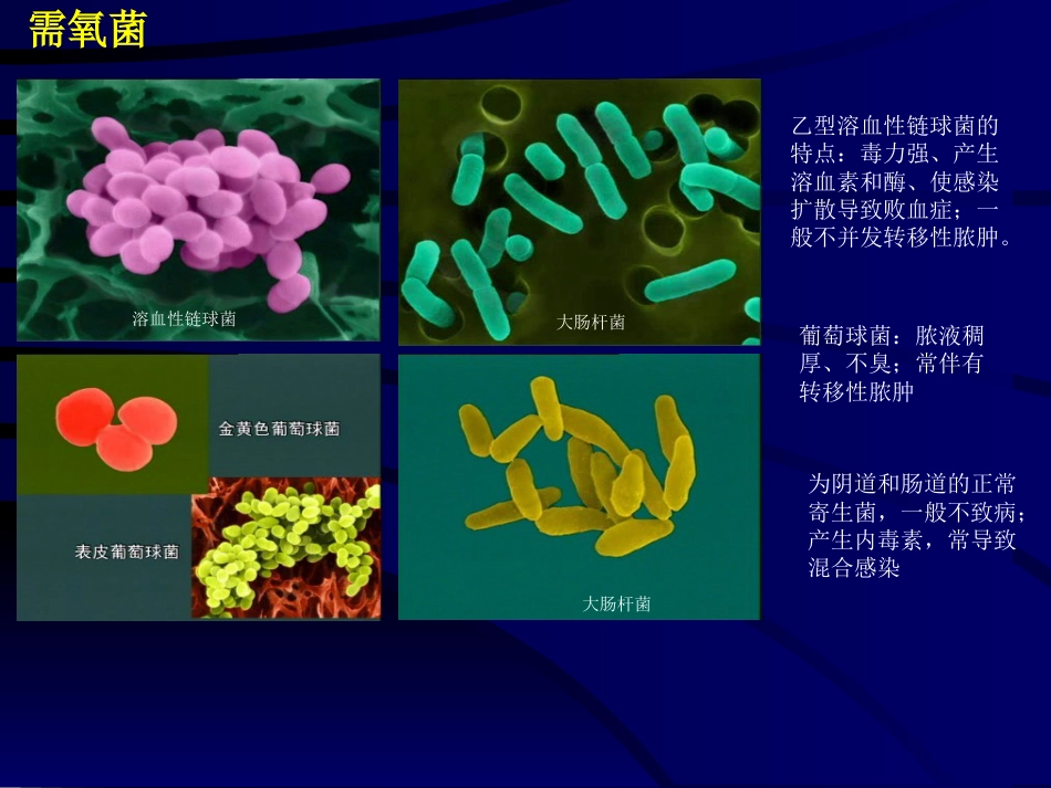 妇产科-盆腔炎_第8页