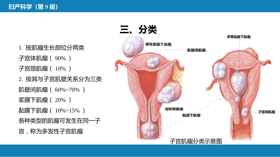 子宫肿瘤_第7页