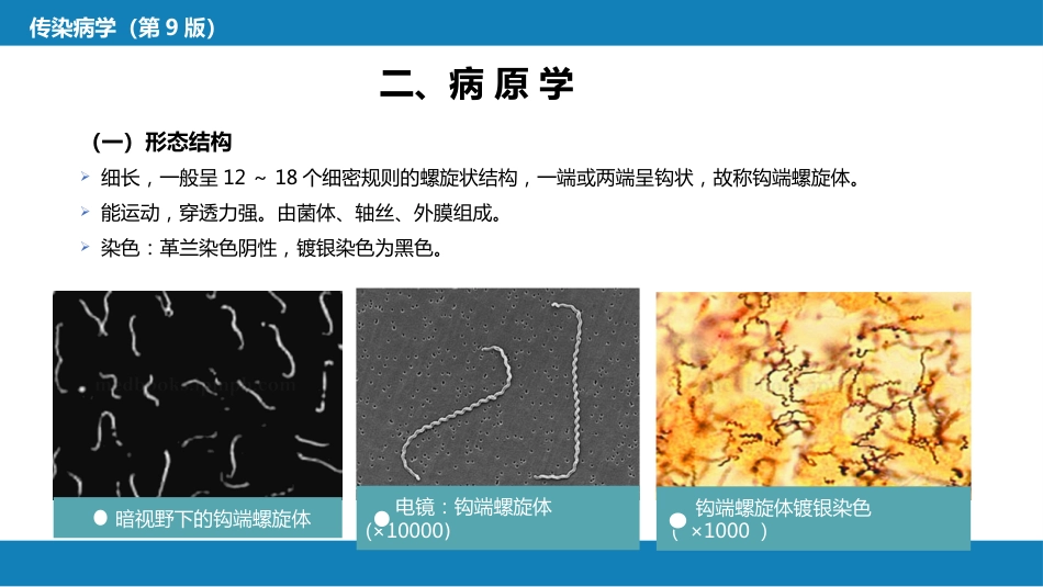 第六章 螺旋体病 第一节 钩端螺旋体病_第9页