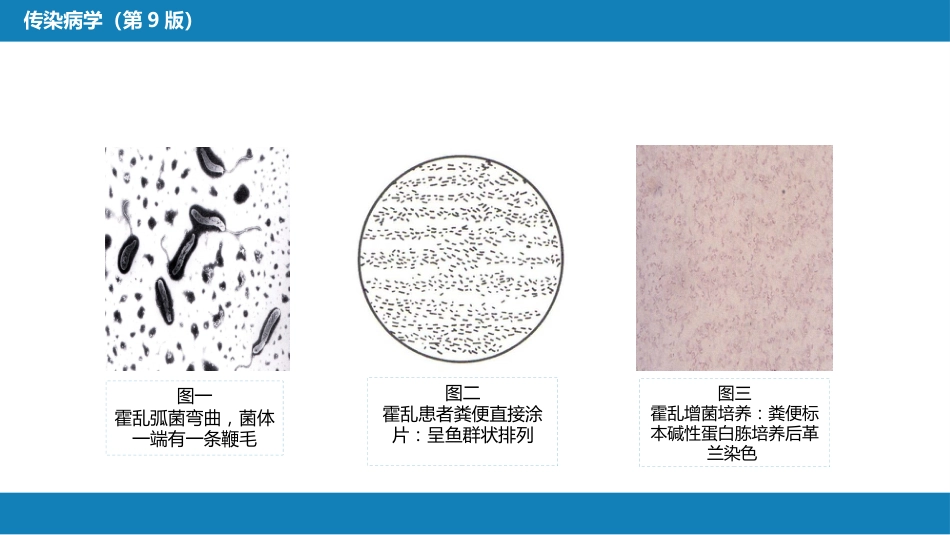 第四章 细菌性传染病 第四节 霍乱_第9页