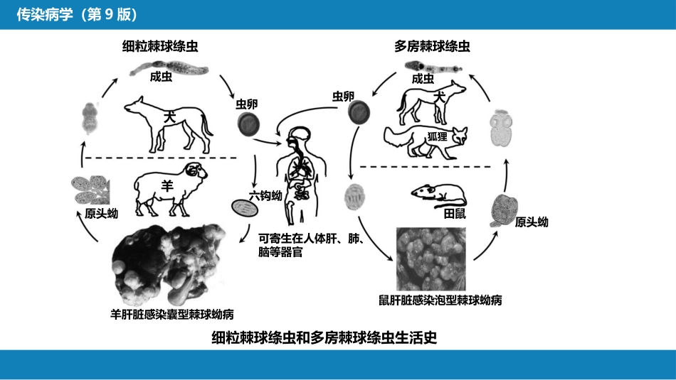第八章 蠕虫病 第六节 棘球蚴病（包虫病）_第7页