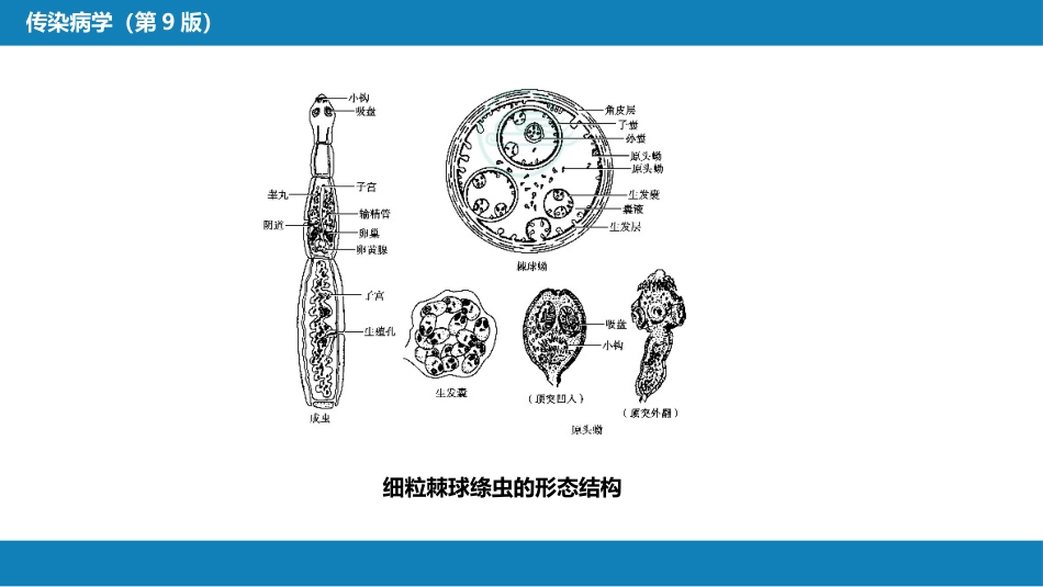 第八章 蠕虫病 第六节 棘球蚴病（包虫病）_第8页