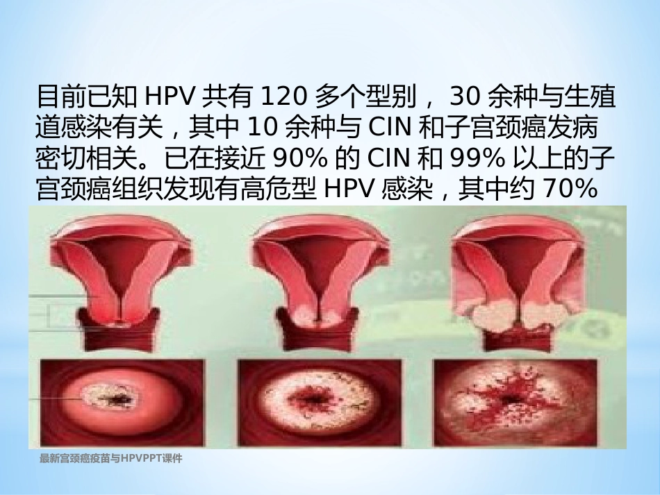 最新宫颈癌疫苗与HPVPPT课件_第3页