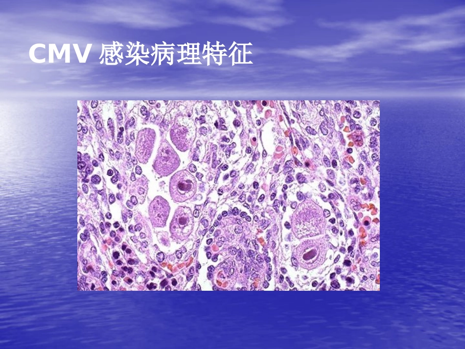 先天巨细胞病毒感染_第6页