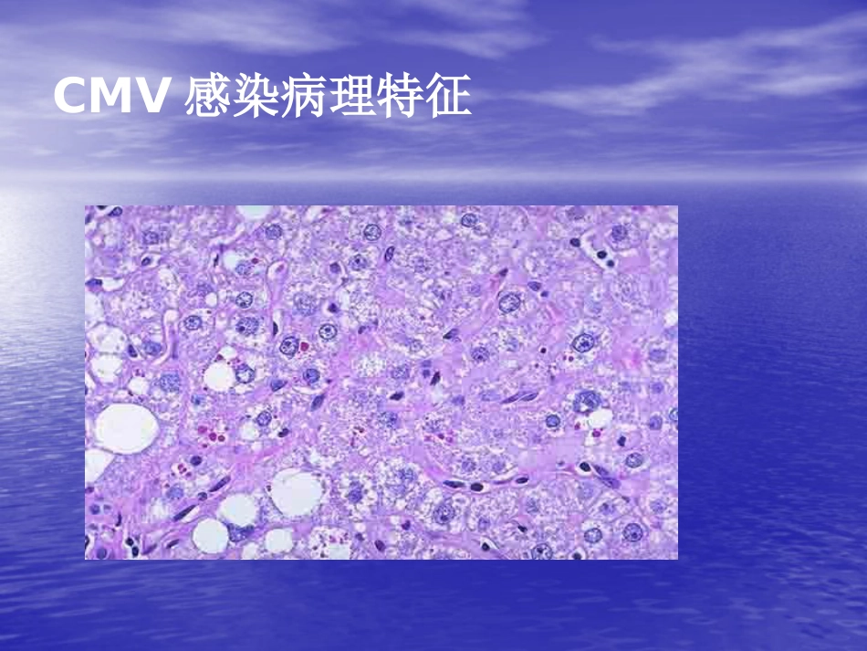 先天巨细胞病毒感染_第7页