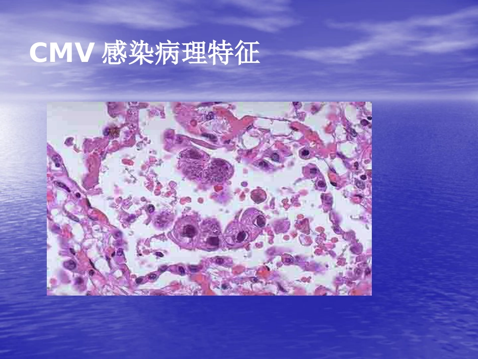 先天巨细胞病毒感染_第8页