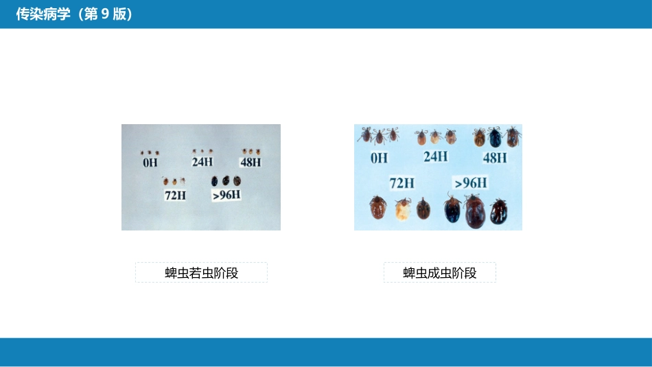 第六章 螺旋体病 第四节 莱姆病_第13页