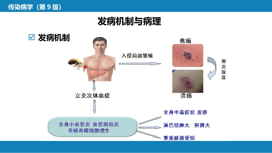 第三章 立克次体病 第二节 恙虫病_第12页