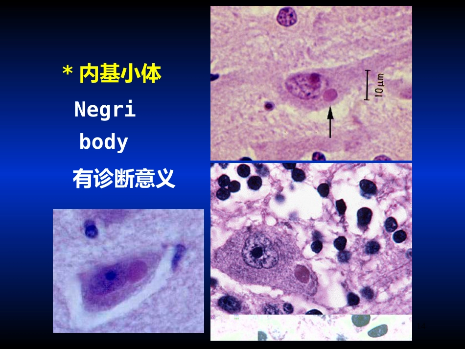 其他病毒狂犬病病毒_第14页