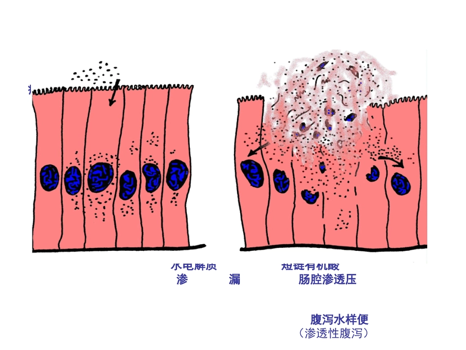 小儿轮状病毒肠炎的诊治进展_第10页