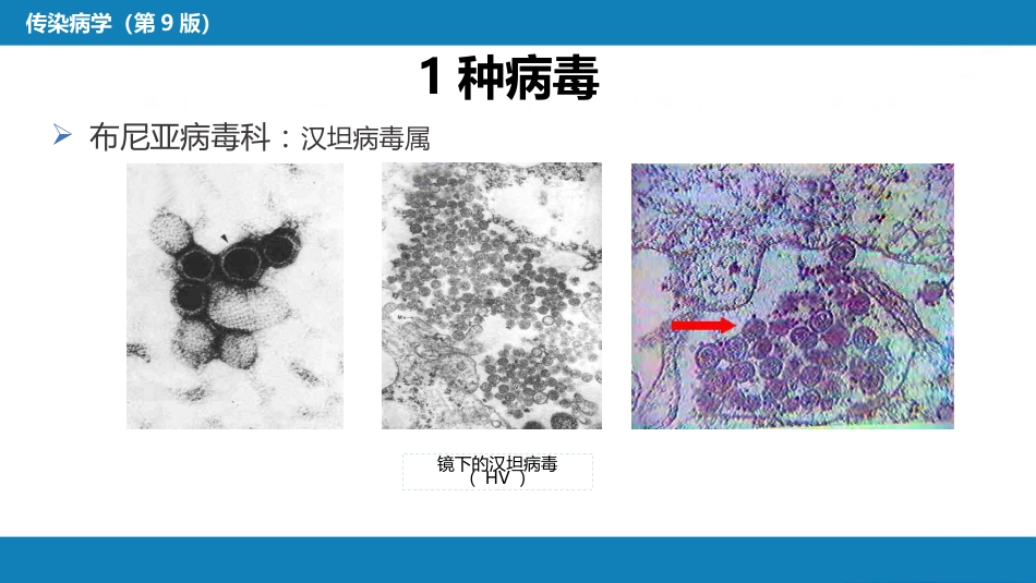 第二章 病毒性传染病 第七节 肾综合征出血热_第9页