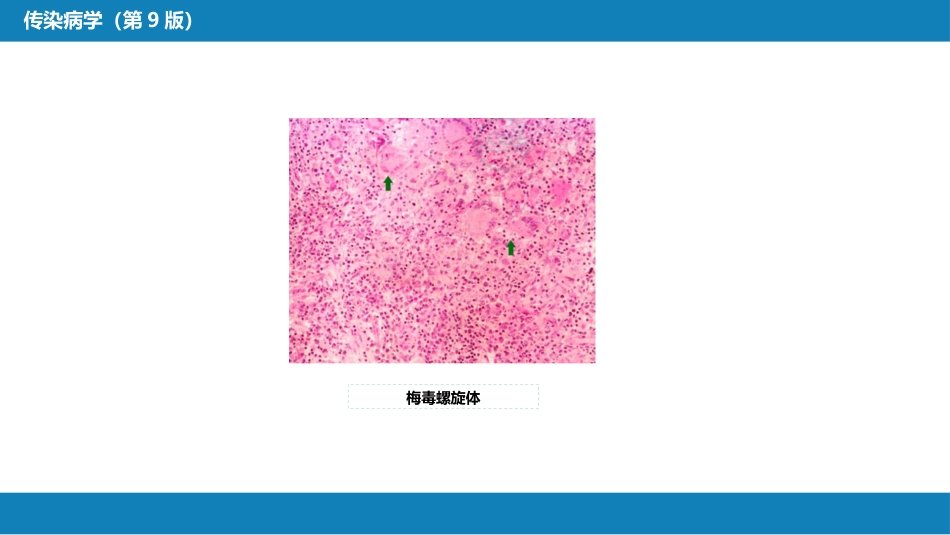 第六章 螺旋体病 第二节 梅毒_第9页