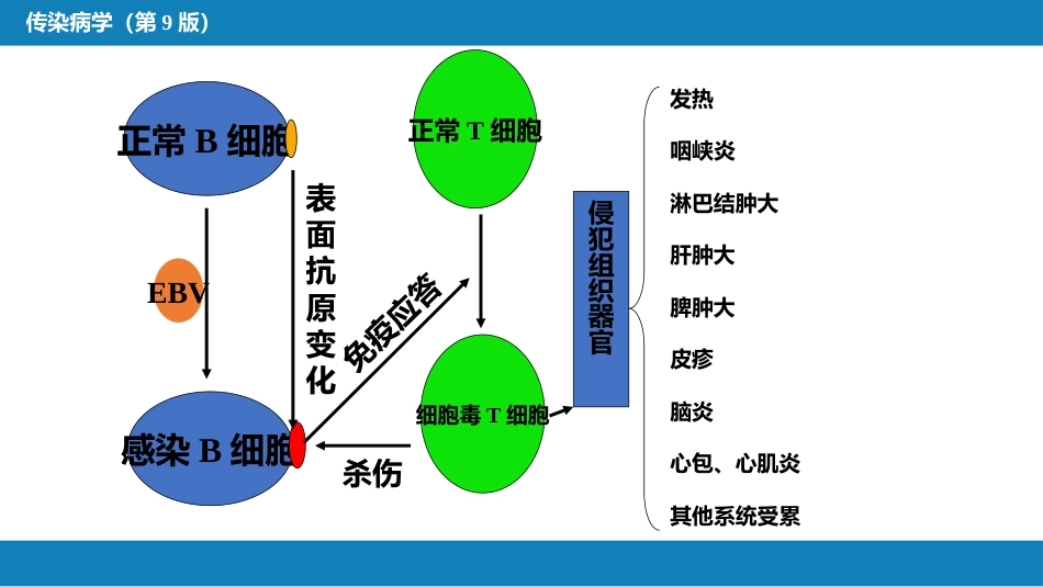 第二章 病毒性传染病 第十节 传染性单核细胞增多症_第12页