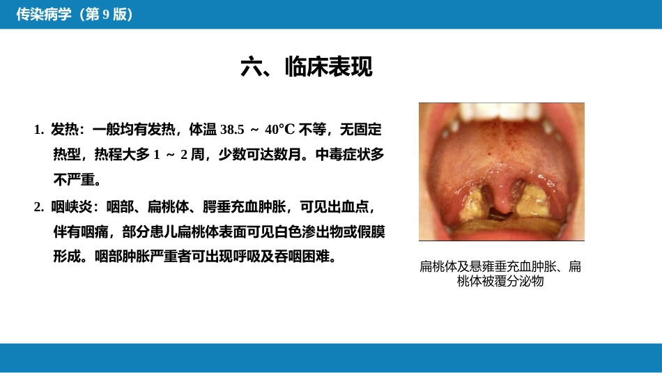 第二章 病毒性传染病 第十节 传染性单核细胞增多症_第15页