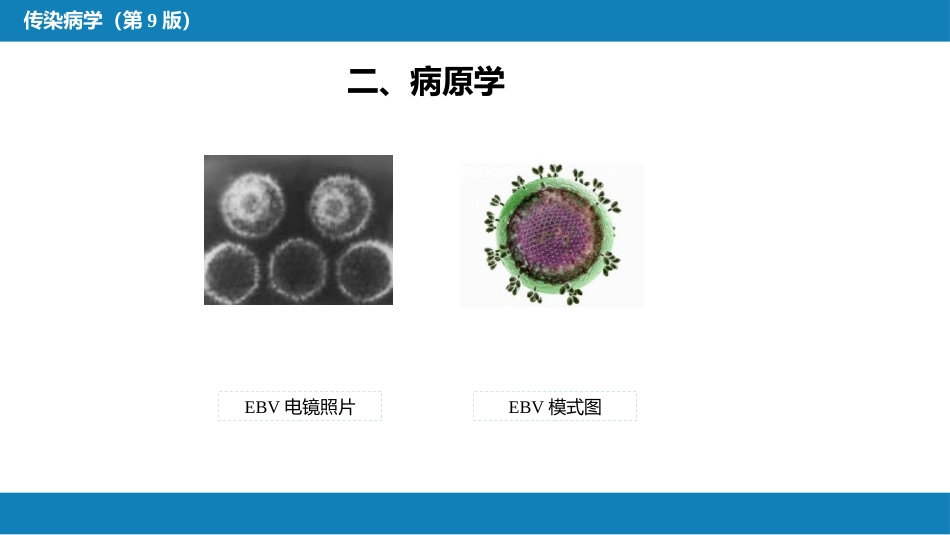 第二章 病毒性传染病 第十节 传染性单核细胞增多症_第8页