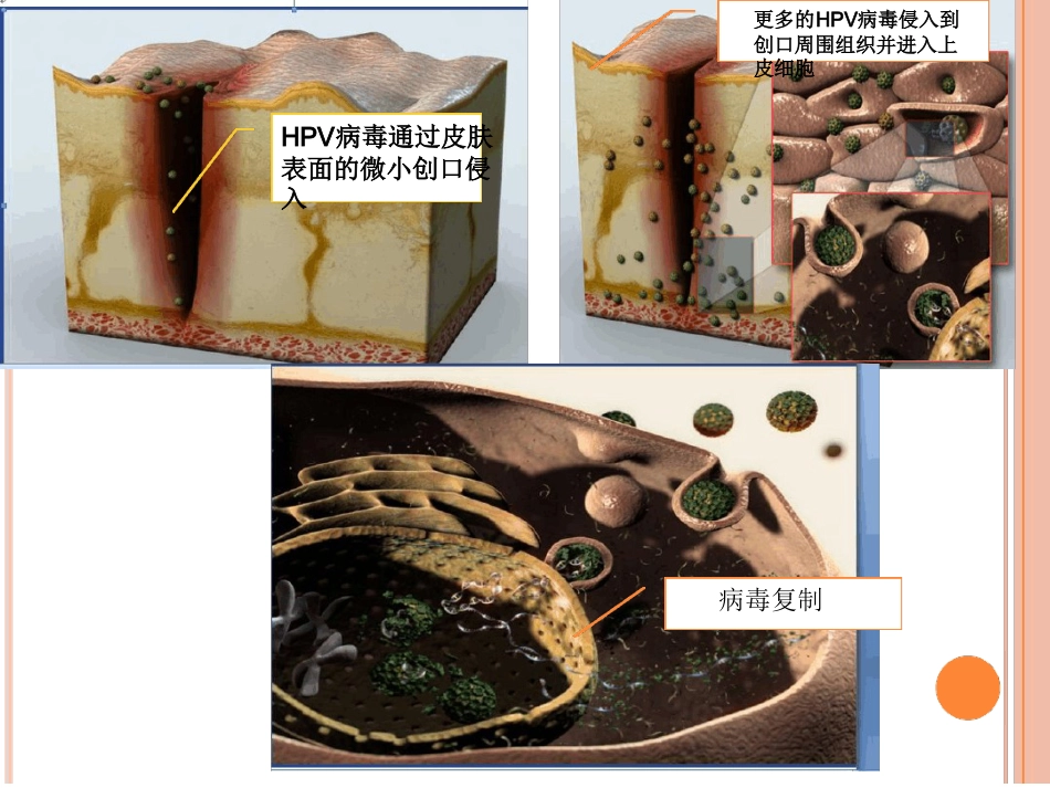 认识HPV病毒感染最新优质ppt课件_第7页