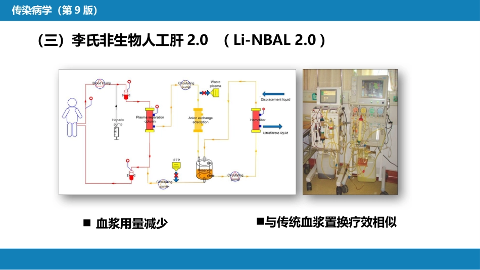 第十章 其他 第五节 人工肝脏_第14页