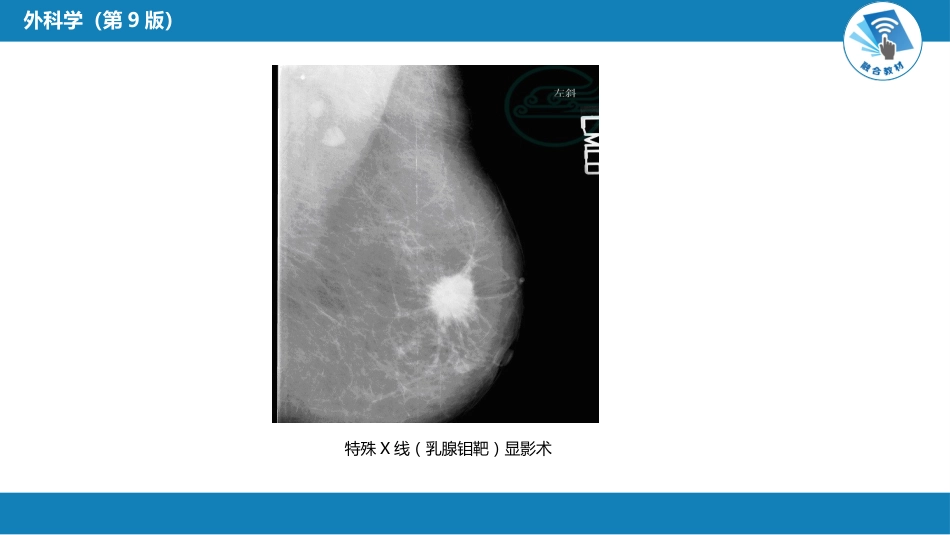 其他综合：肿瘤_第11页