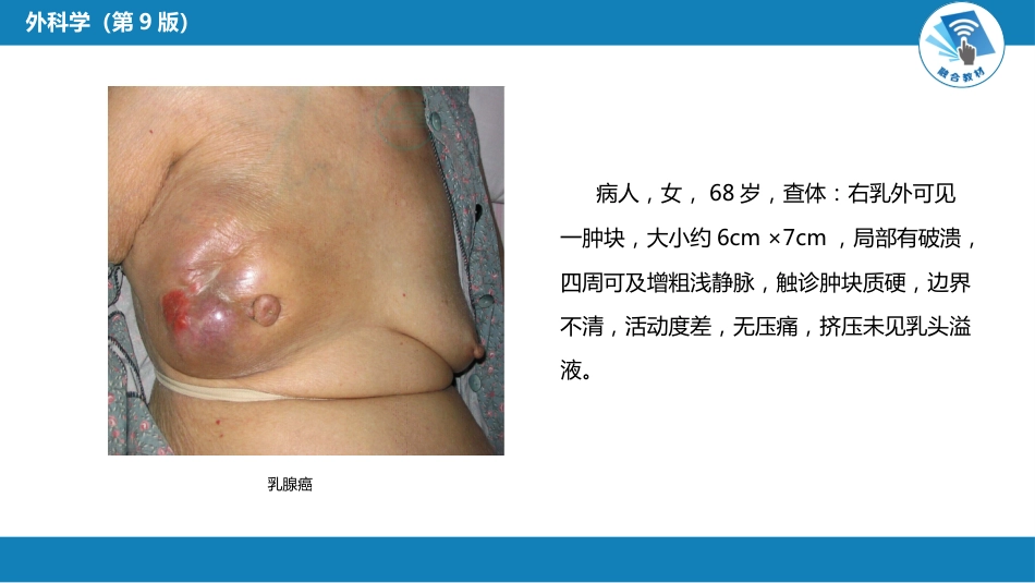 其他综合：肿瘤_第8页