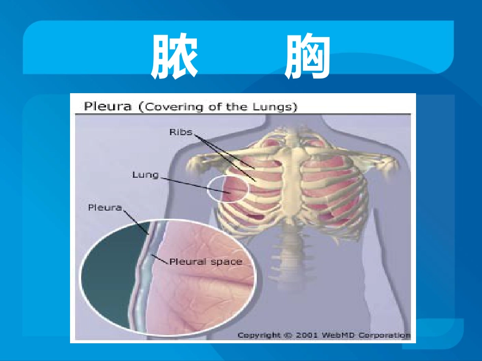 传染科-脓胸_第2页