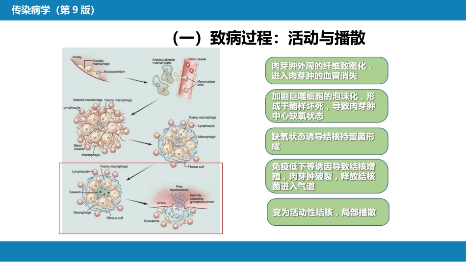第四章 细菌性传染病 第十三节 结核病_第10页