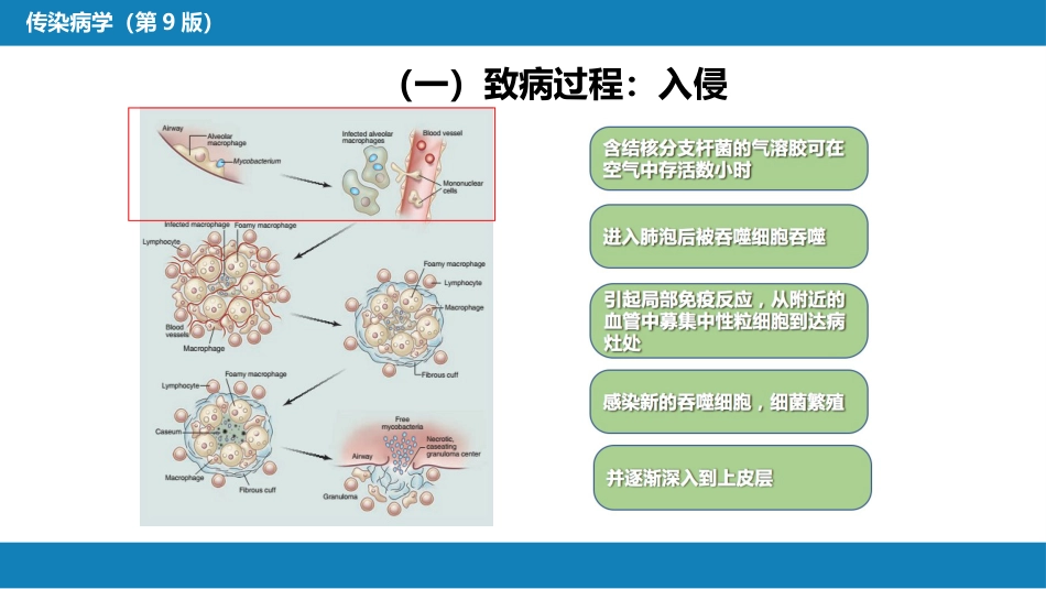 第四章 细菌性传染病 第十三节 结核病_第8页