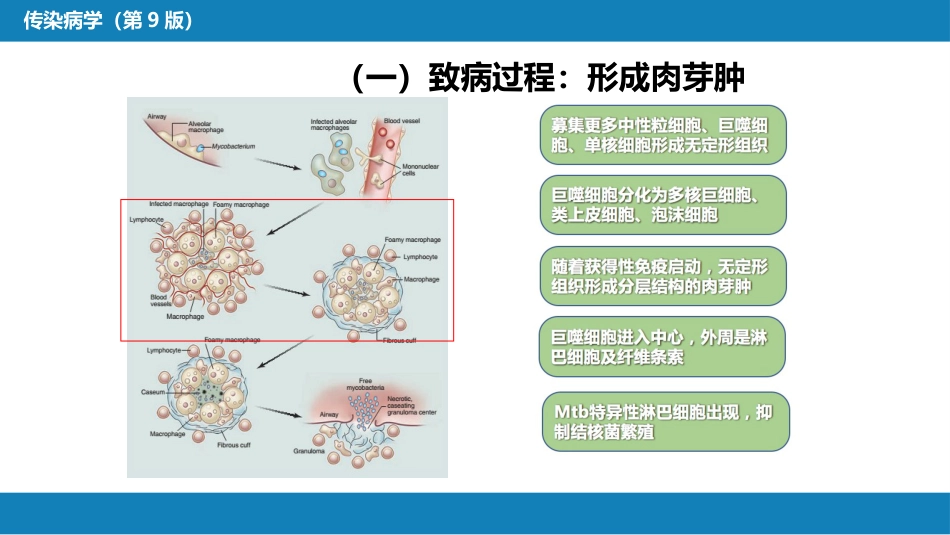 第四章 细菌性传染病 第十三节 结核病_第9页