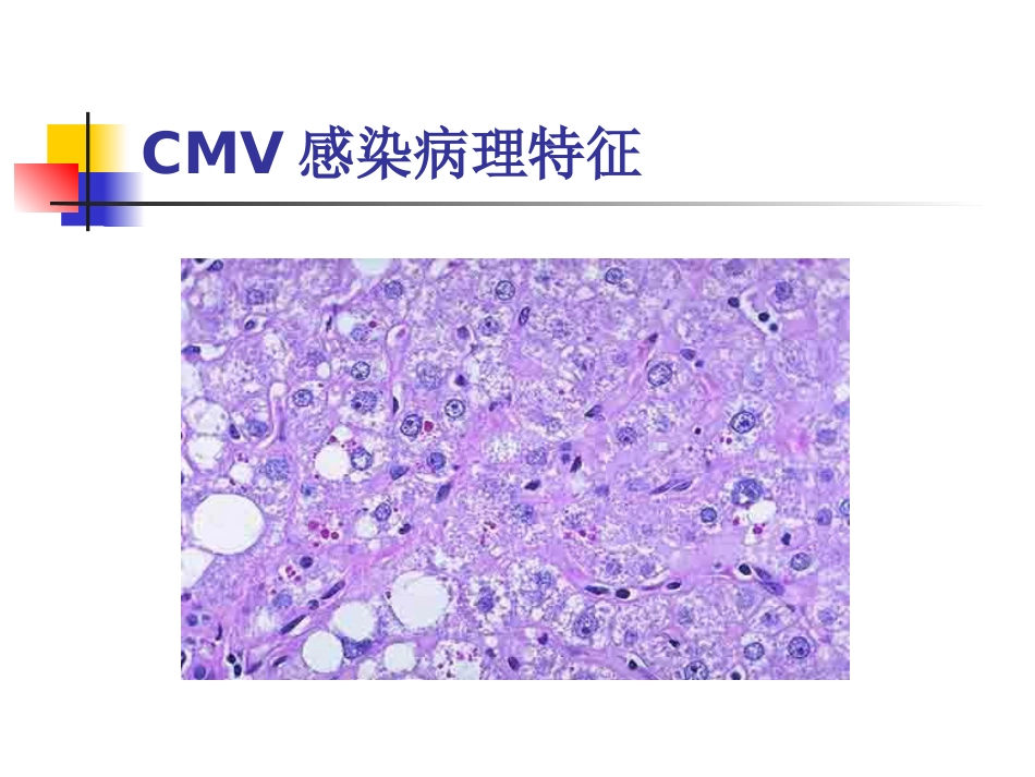 先天巨细胞病毒感染(1)_第7页