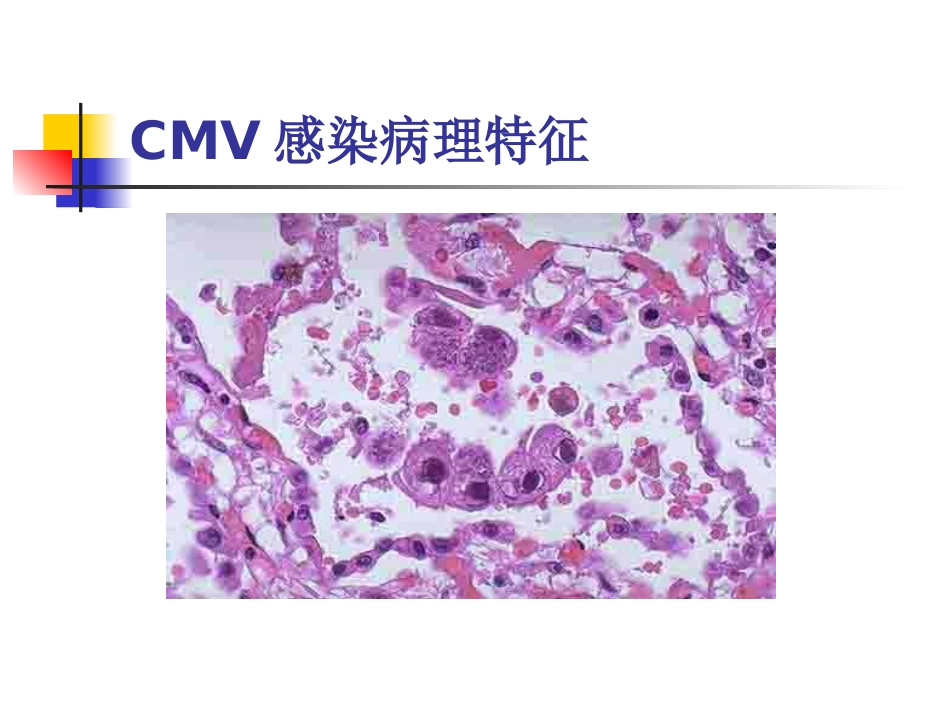 先天巨细胞病毒感染(1)_第8页