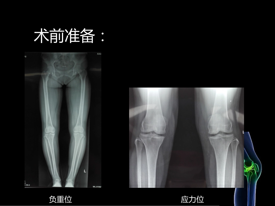 HTO_第10页