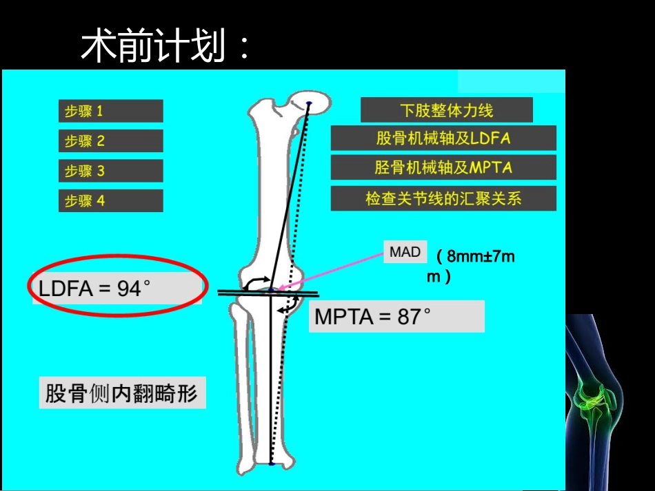 HTO_第12页