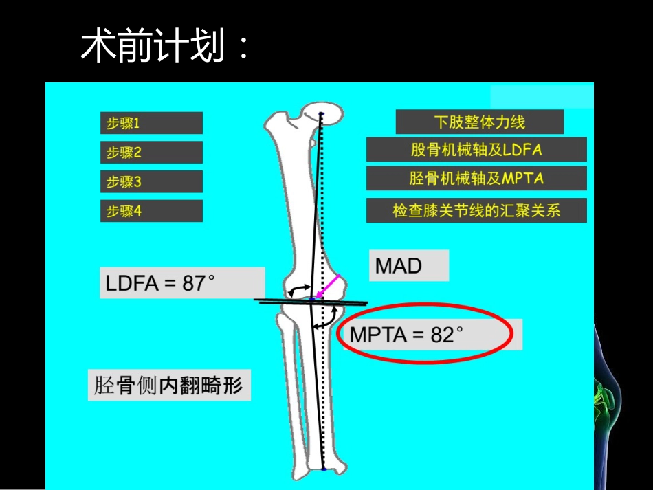 HTO_第13页