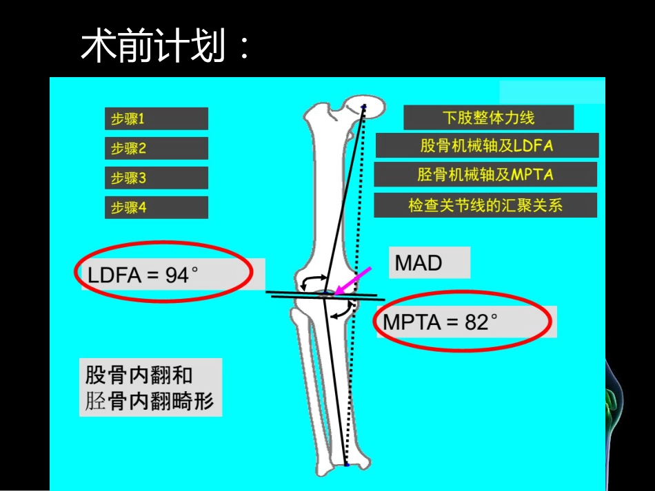 HTO_第14页