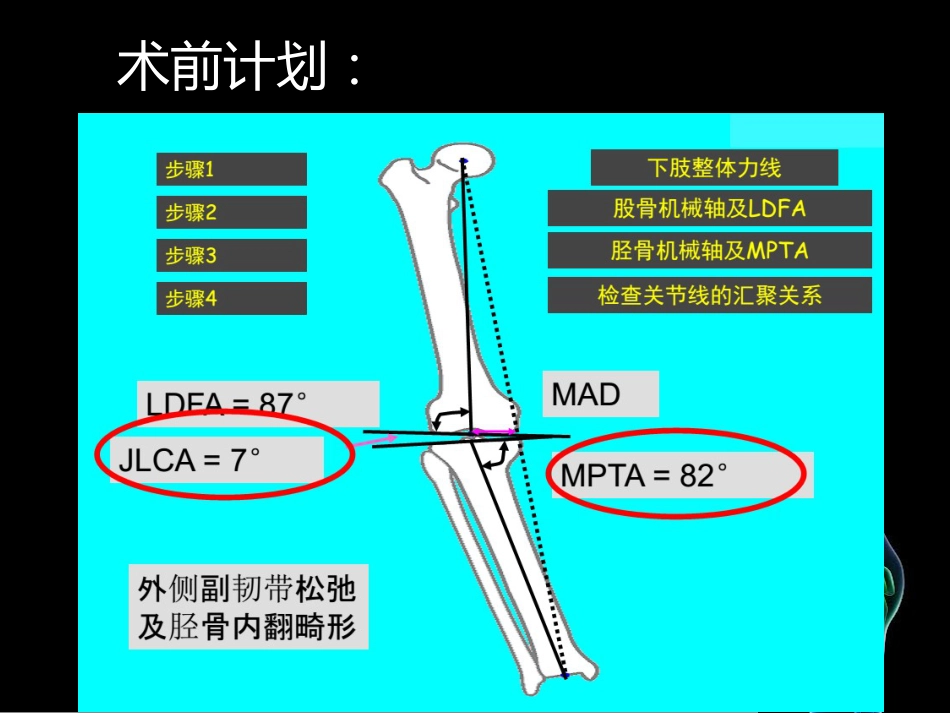 HTO_第15页